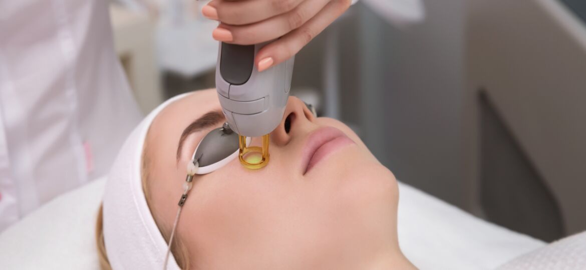 FACIAL LASER hair removal treatment