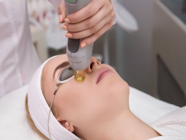 FACIAL LASER hair removal treatment
