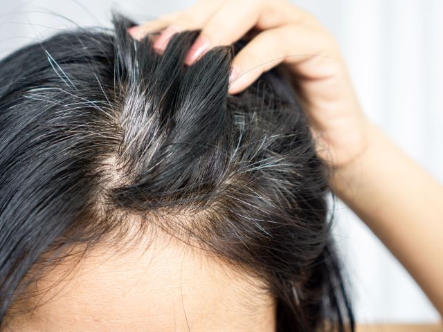 Closeup,Asian,Woman,Having,Problem,With,Grey,,White,Hair,Growing