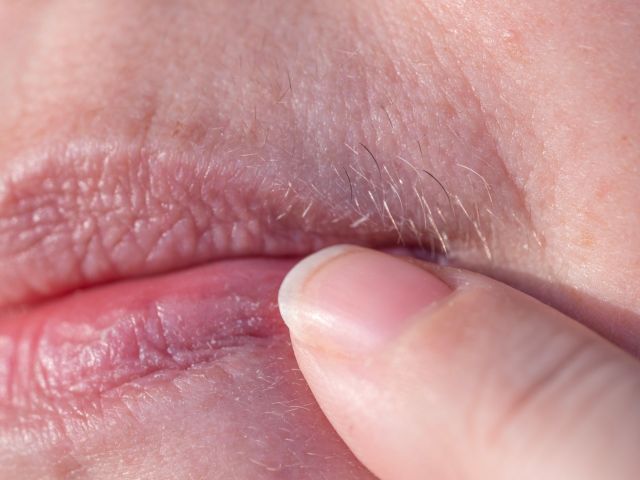 Close-up,Mature,Female,Lips,,Removes,Excess,Facial,Hair,,Excessive,Hair