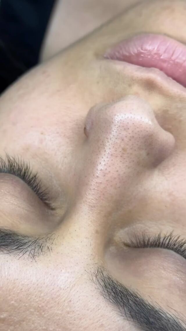 Congested skin and in of a good Facial? We have exactly what you need for glowing skin. Book a 1hr Hydra Facial with us for £80 and get that glow ✨